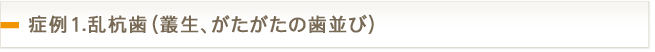 症例1.乱杭歯（叢生、がたがたの歯並び）