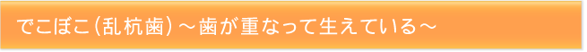 でこぼこ（乱杭歯）～歯が重なって生えている～